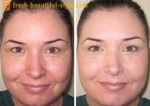Toner do twarzy - co to jest i jak z niego korzystać? Skin Care Products twarzy