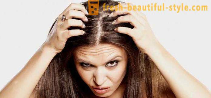 Dlaczego szybko zhirneyut włosy? Możliwe przyczyny, cechy i sposoby leczenia