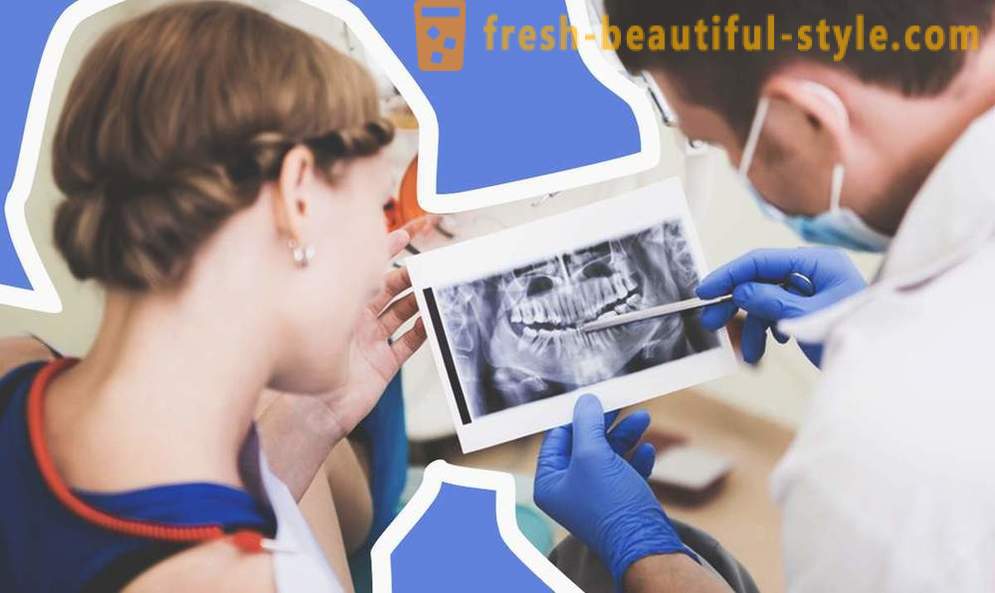4 pytania o implantach dentystycznych
