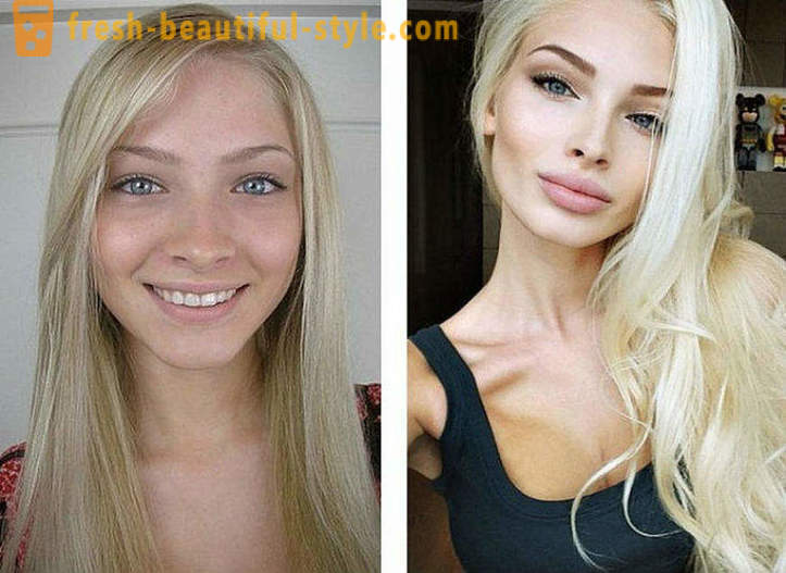 10 Rosyjskiej piękności przed i po plastiku