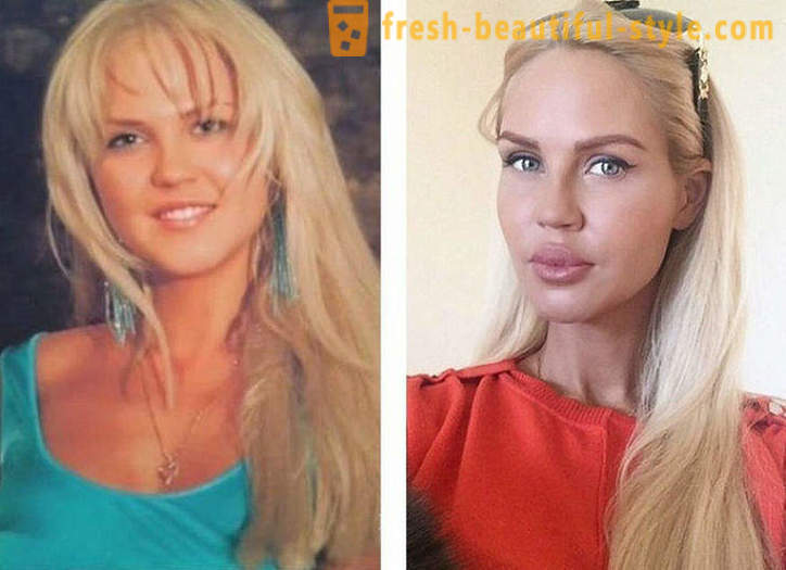 10 Rosyjskiej piękności przed i po plastiku
