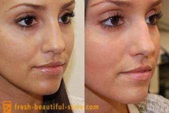 Jak zmniejszyć nos z makijażem? Wizualnie zmniejszyć nos