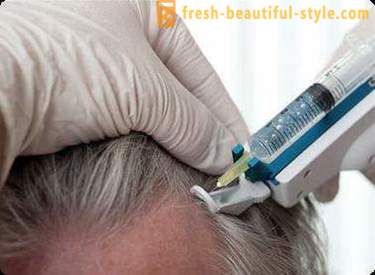 Mezoterapia dla włosów: narzędzi makijaż i przeciwwskazania