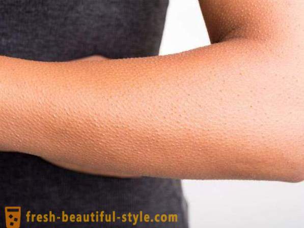 Jak pozbyć gęsiej skóry na pośladkach i rękach?
